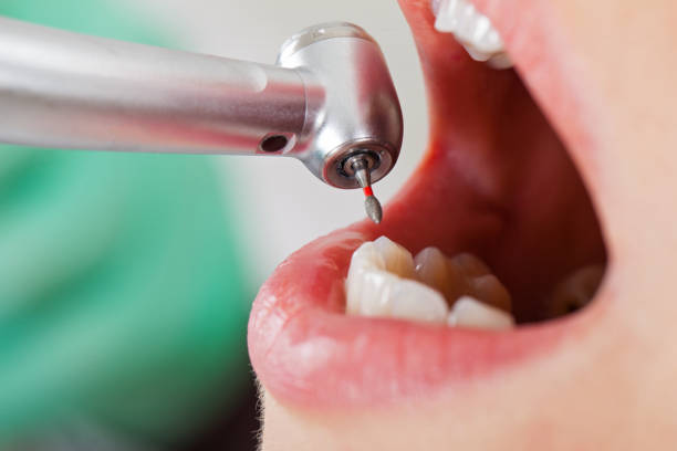 Best Emergency Dental Care for Trauma or Injury in Mineral Springs, NC